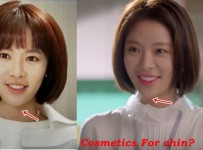 Hwang Jung Eum plastic surgery before and after photos