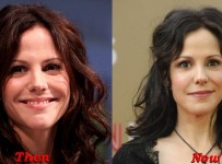 Mary Louise Parker Plastic Surgery Before And After Face Photos
