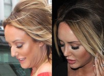 Charlotte Crosby nose job plastic surgery before and after photos