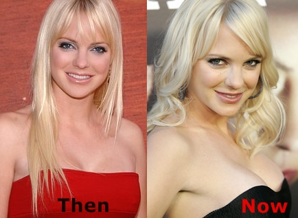 Did Anna Faris Had Breasts Implants Plastic Surgery Or Not