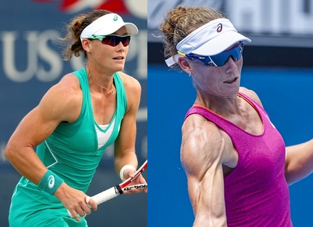 Samantha Stosur Breast Implants Surgery Photos