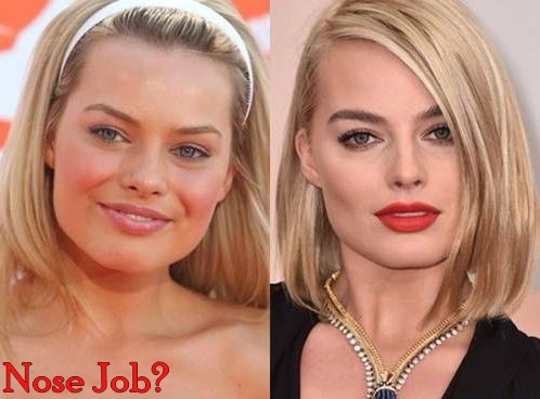 Margot Robbie Plastic Surgery Before And After Nose Job Photos