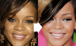 Rihanna Forehead Reduce Size Surgery Before And After Photos