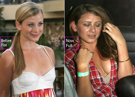 Lo Bosworth Plastic Surgery Before And After Breasts Implants Photos