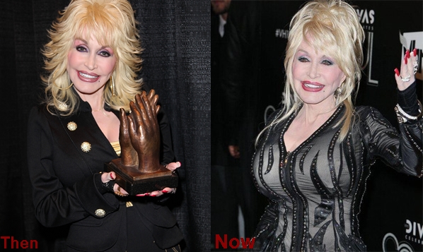 Dolly Parton Breasts Implants Before And After Photos