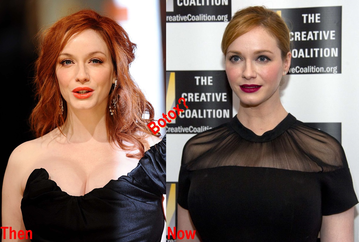 Christina Hendricks Plastic Surgery Before And After Pictures