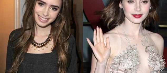 Lily Collins Plastic Surgery Before And After Boobs Job Photos