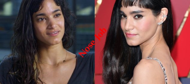 Sofia Boutella plastic surgery before and after Nose Job photos